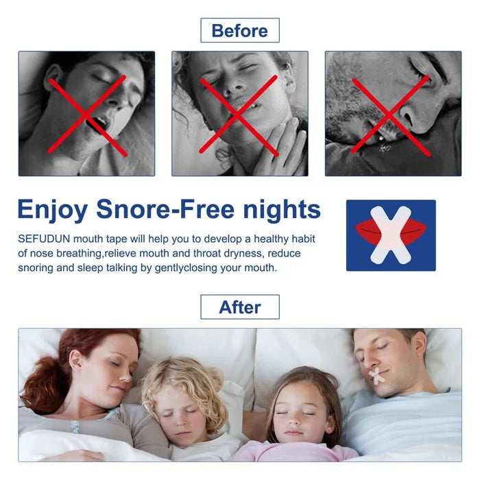 Breath and SnoreSleep Tape for Better Breathing & Reduced Snoring